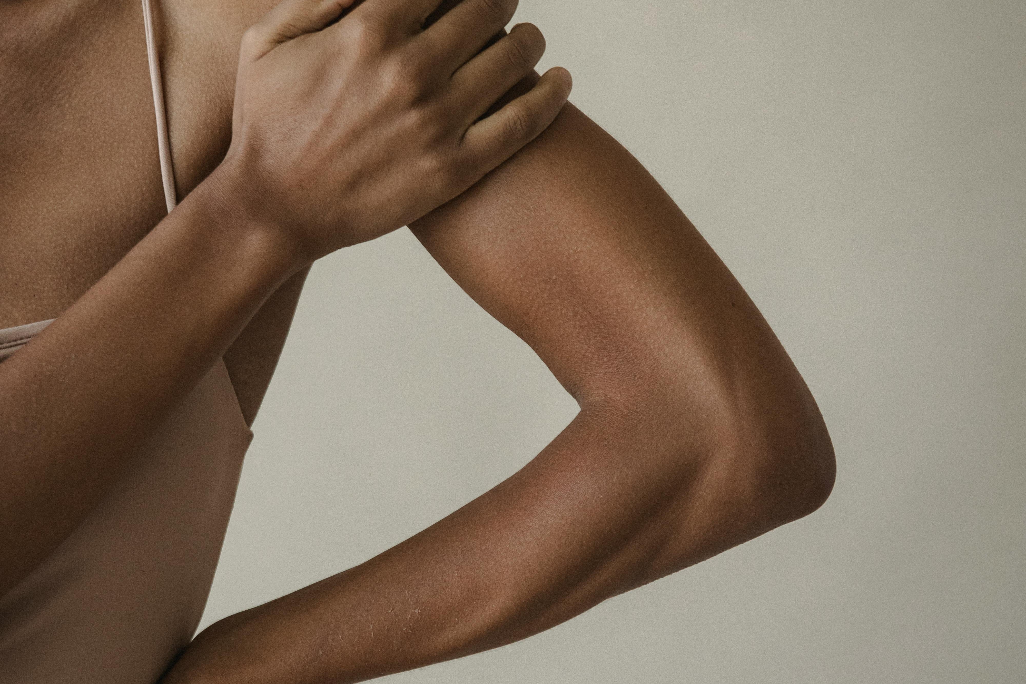 Keratosis Pilaris - What It Is and What Actually Helps